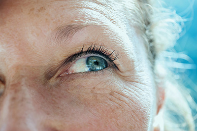 The image shows a close-up of a person s face with a focus on their eye, which is looking off to the side. The individual appears to be an adult with fair skin and visible aging, such as wrinkles and age spots. The background is blurred but suggests a bright outdoor setting.